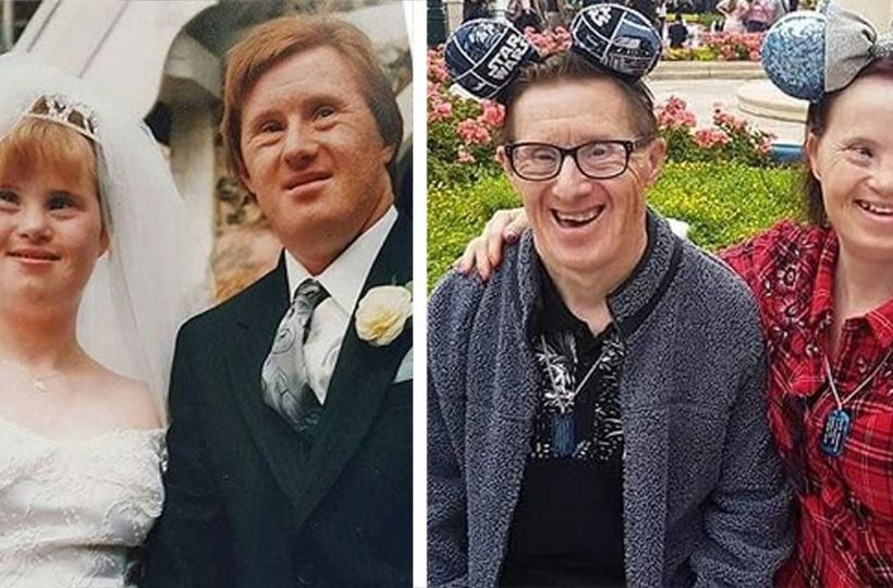 People Were Against Their Relations: The Couple With Down’s Syndrome Married And Are Already 25 Years Happy Together!