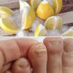 Discover the Power of Lemon and Salt in Tackling Toenail Fungus