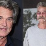 What medical conditions did Kurt Russell have?