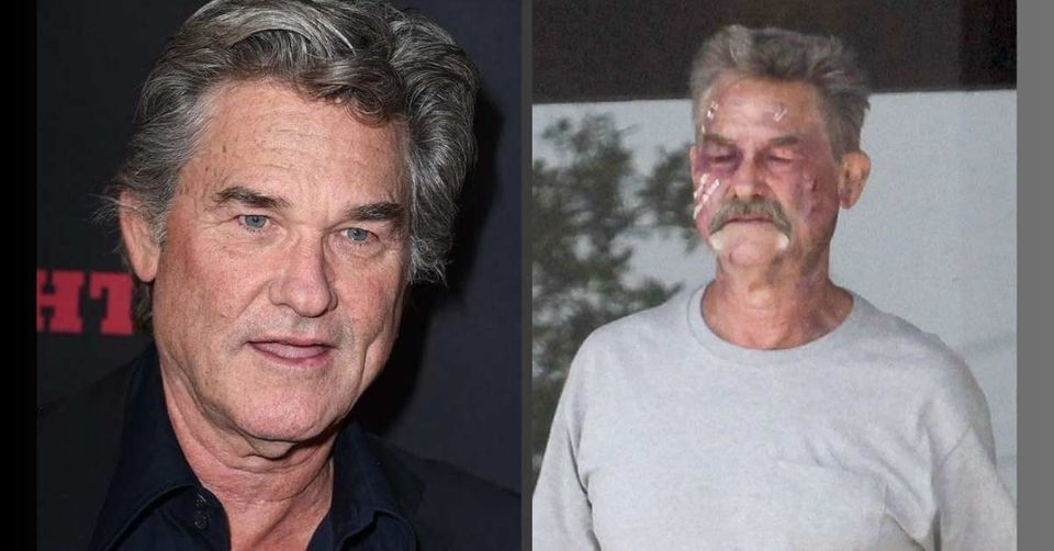 What medical conditions did Kurt Russell have?