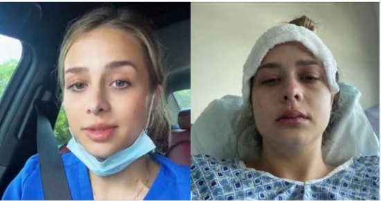 24-Year-Old Diagnosed With Stage 3 Cancer After She Overlooked Continuous Burping