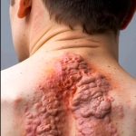 Skin Signals Used to Diagnose Serious Diseases