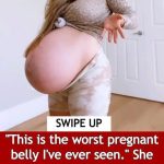 Harsh Remarks Including Her Huge Belly. “The worst pregnant belly I have ever seen”