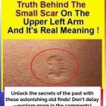 Do You Know The Real Significance Of The Small Scar